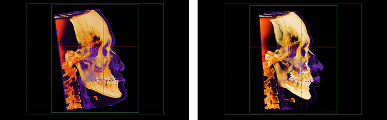 33bacc88452b26c8099a2d987e05d399_1523496484_8306.jpg